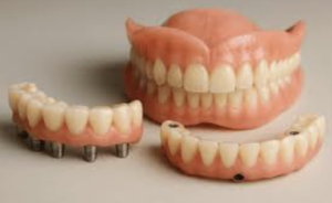 prótesis dentales en Jerez