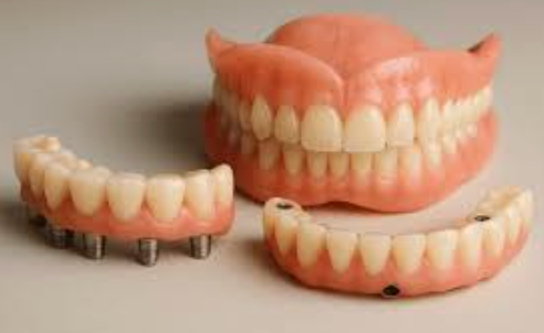 prótesis dentales en Jerez